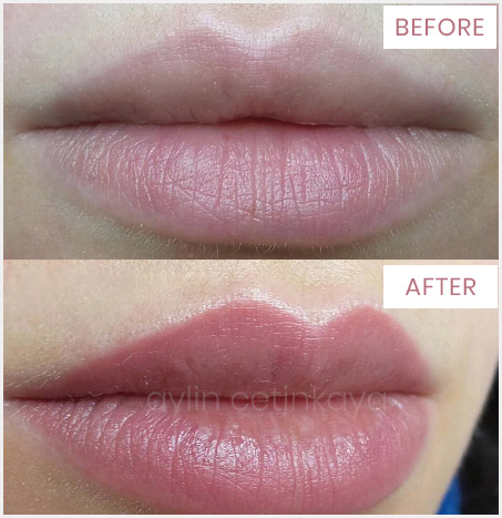 What To Expect Before  After Getting A Lip Blushing Tattoo